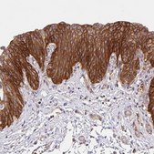 Anti-ITGA2 antibody produced in rabbit Prestige Antibodies&#174; Powered by Atlas Antibodies, affinity isolated antibody, buffered aqueous glycerol solution