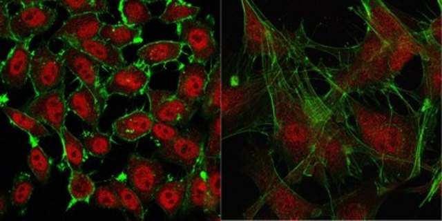 Anti-Actin from rabbit, purified by affinity chromatography