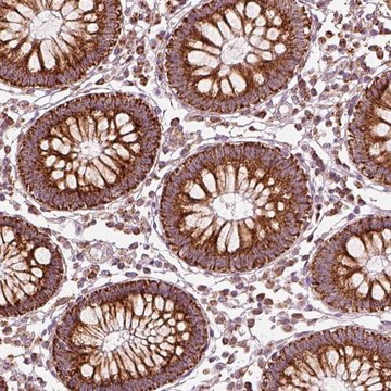 Anti-ENTPD6 antibody produced in rabbit Prestige Antibodies&#174; Powered by Atlas Antibodies, affinity isolated antibody