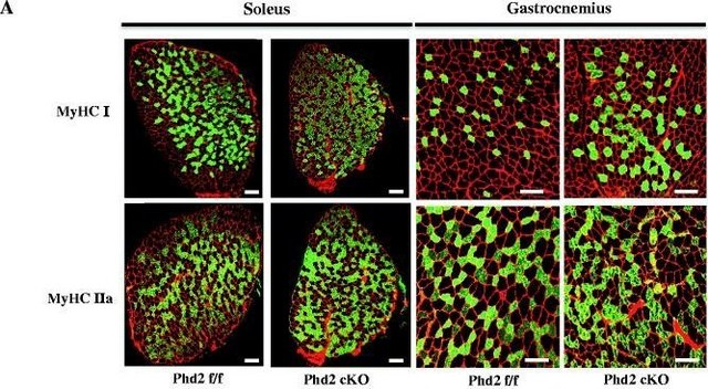 Monoclonal Anti-Myosin (Skeletal, Slow) antibody produced in mouse clone NOQ7.5.4D, ascites fluid