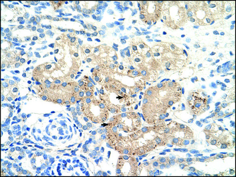 Anti-DLAT antibody produced in rabbit IgG fraction of antiserum