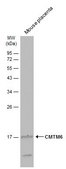 Anti-CMTM6 antibody produced in rabbit affinity isolated antibody, buffered aqueous solution
