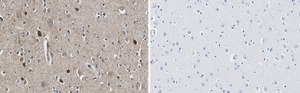 Anti-GAD67 Antibody, clone 4B5 ZooMAb&#174; Rabbit Monoclonal recombinant, expressed in HEK 293 cells