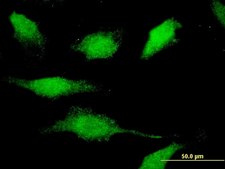 Monoclonal Anti-CAMK1D, (N-terminal) antibody produced in mouse clone 3H8, purified immunoglobulin, buffered aqueous solution