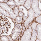 Anti-LOXL4 antibody produced in rabbit Prestige Antibodies&#174; Powered by Atlas Antibodies, affinity isolated antibody, buffered aqueous glycerol solution