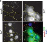 Monoclonal Anti-Vinculin antibody produced in mouse clone VIN-11-5, ascites fluid