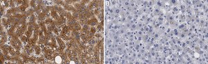 Anti-ABCA1 Antibody, clone 1J11 ZooMAb&#174; Rabbit Monoclonal recombinant, expressed in HEK 293 cells