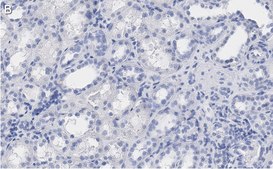 Anti-Erythropoietin Antibody, clone 6E5, ZooMAb&#174; Rabbit Monoclonal recombinant, expressed in HEK 293 cells