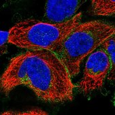 Anti-SLC19A1 antibody produced in rabbit Prestige Antibodies&#174; Powered by Atlas Antibodies, affinity isolated antibody, buffered aqueous glycerol solution