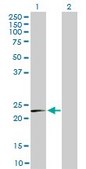 Monoclonal Anti-MRPL12 antibody produced in mouse clone 3B12-1A3, purified immunoglobulin, buffered aqueous solution