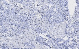Anti-Zyxin Antibody, clone 2F17 ZooMAb&#174; Rabbit Monoclonal recombinant, expressed in HEK 293 cells