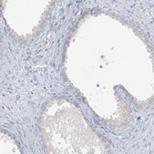 Anti-SCML1 antibody produced in rabbit Prestige Antibodies&#174; Powered by Atlas Antibodies, affinity isolated antibody, buffered aqueous glycerol solution