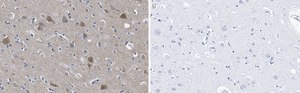 Anti-PSD-95 Antibody, clone 2B20 ZooMAb&#174; Rabbit Monoclonal recombinant, expressed in HEK 293 cells