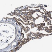 Anti-EMP2 antibody produced in rabbit Prestige Antibodies&#174; Powered by Atlas Antibodies, affinity isolated antibody, buffered aqueous glycerol solution