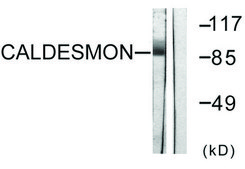 Anti-Caldesmon antibody produced in rabbit affinity isolated antibody