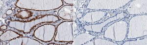 Anti-Peroxiredoxin 1 Antibody, clone 1G22 ZooMAb&#174; Rabbit Monoclonal recombinant, expressed in HEK 293 cells