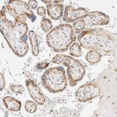 Anti-ITGA6 antibody produced in rabbit Prestige Antibodies&#174; Powered by Atlas Antibodies, affinity isolated antibody, buffered aqueous glycerol solution