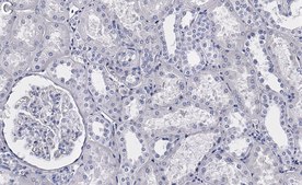 Anti-Raf-1 Antibody, clone 1I3 ZooMAb&#174; Rabbit Monoclonal recombinant, expressed in HEK 293 cells