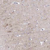 Anti-PDYN antibody produced in rabbit Prestige Antibodies&#174; Powered by Atlas Antibodies, affinity isolated antibody, buffered aqueous glycerol solution