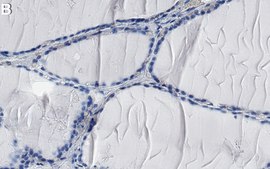Anti-SETD8/KMT5A Antibody, clone 5L10 ZooMAb&#174; Rabbit Monoclonal recombinant, expressed in HEK 293 cells