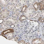 Anti-PLGRKT antibody produced in rabbit Ab1, Prestige Antibodies&#174; Powered by Atlas Antibodies, affinity isolated antibody, buffered aqueous glycerol solution