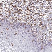 Anti-TNS3 antibody produced in rabbit Prestige Antibodies&#174; Powered by Atlas Antibodies, affinity isolated antibody, buffered aqueous glycerol solution