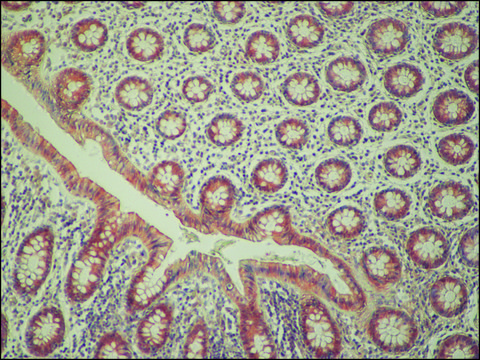 Anti-C9orf72 antibody produced in rabbit affinity isolated antibody