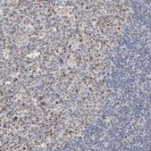 Anti-UQCRC1 antibody produced in rabbit Ab1, Prestige Antibodies&#174; Powered by Atlas Antibodies, affinity isolated antibody, buffered aqueous glycerol solution