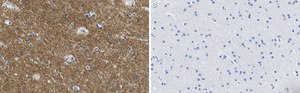 Anti-KCNQ2 Antibody, clone 2G18 ZooMAb&#174; Rabbit Monoclonal recombinant, expressed in HEK 293 cells