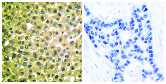 Anti-Retinoic Acid Receptor &#946;, C-Terminal antibody produced in rabbit affinity isolated antibody