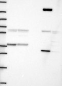 Anti-SMN1 antibody produced in rabbit Prestige Antibodies&#174; Powered by Atlas Antibodies, affinity isolated antibody, buffered aqueous glycerol solution