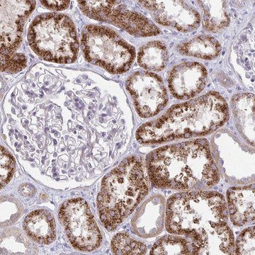 Anti-KATNBL1 antibody produced in rabbit Prestige Antibodies&#174; Powered by Atlas Antibodies, affinity isolated antibody, buffered aqueous glycerol solution