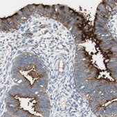 Anti-ALPL antibody produced in rabbit Ab2, Prestige Antibodies&#174; Powered by Atlas Antibodies, affinity isolated antibody, buffered aqueous glycerol solution