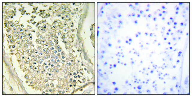 Anti-ATP7B antibody produced in rabbit affinity isolated antibody