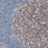 Anti-IGF2BP3 antibody produced in rabbit Prestige Antibodies&#174; Powered by Atlas Antibodies, affinity isolated antibody, buffered aqueous glycerol solution