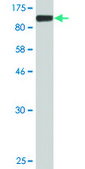 Monoclonal Anti-MMP9 antibody produced in mouse clone 2H4, purified immunoglobulin, buffered aqueous solution