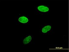 Anti-LBR antibody produced in mouse IgG fraction of antiserum, buffered aqueous solution