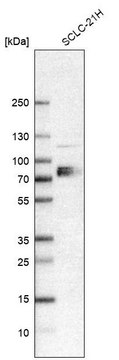 Anti-SLC7A1 antibody produced in rabbit affinity isolated antibody, buffered aqueous glycerol solution