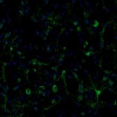 Anti-ECH1 antibody produced in rabbit Prestige Antibodies&#174; Powered by Atlas Antibodies, affinity isolated antibody, buffered aqueous glycerol solution