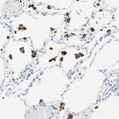 Anti-CYSLTR1 antibody produced in rabbit Prestige Antibodies&#174; Powered by Atlas Antibodies, affinity isolated antibody, buffered aqueous glycerol solution