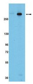 mTOR phosphorylation Pathway Explorer Antibody MiniPack This Antibody pack of Anti-mTOR antibodies contains Anti-phospho-mTOR Antibody(Ser2481), Anti-phospho-mTOR Antibody (Thr2446), Anti-phospho-mTOR (Ser2448).