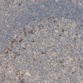 Anti-ALOX12 antibody produced in rabbit Prestige Antibodies&#174; Powered by Atlas Antibodies, affinity isolated antibody, buffered aqueous glycerol solution