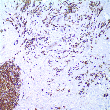 MUC1 (MRQ-17) Mouse Monoclonal Antibody