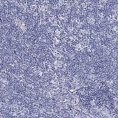 Anti-CFTR antibody produced in rabbit Prestige Antibodies&#174; Powered by Atlas Antibodies, affinity isolated antibody, buffered aqueous glycerol solution