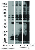 Anti-Acetylated-Lysine antibody, Rabbit monoclonal recombinant, expressed in HEK 293 cells, clone RM101, purified immunoglobulin