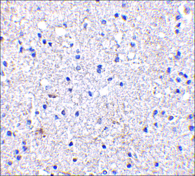 Anti-SCO1 antibody produced in rabbit affinity isolated antibody, buffered aqueous solution