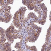 Anti-ATP2B4 antibody produced in rabbit Prestige Antibodies&#174; Powered by Atlas Antibodies, affinity isolated antibody, buffered aqueous glycerol solution