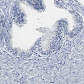 Anti-SLCO2B1 antibody produced in rabbit Prestige Antibodies&#174; Powered by Atlas Antibodies, affinity isolated antibody, buffered aqueous glycerol solution