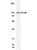 Anti-Vinculin Antibody, clone V284 clone V284, Upstate&#174;, from mouse