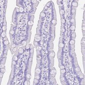 Anti-KCNC1 antibody produced in rabbit Prestige Antibodies&#174; Powered by Atlas Antibodies, affinity isolated antibody, buffered aqueous glycerol solution